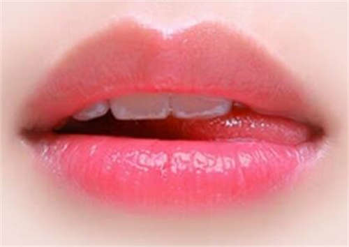 唇系带切除优点和缺点「唇系带过低会影响什么」