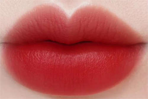 日喀则市康马县唇珠成型的价格要花多少蛮实在-唇珠成型价格表发布?