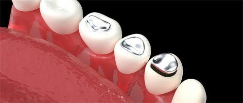 高端牙齿美白大概需要多少钱_牙齿美白的整形医院?