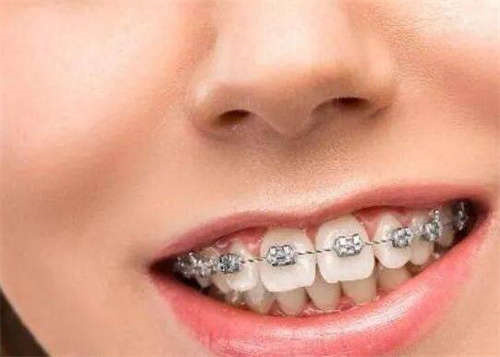 2023年哈尔滨市通河县激光美白牙品质优技术好的医生有哪几个