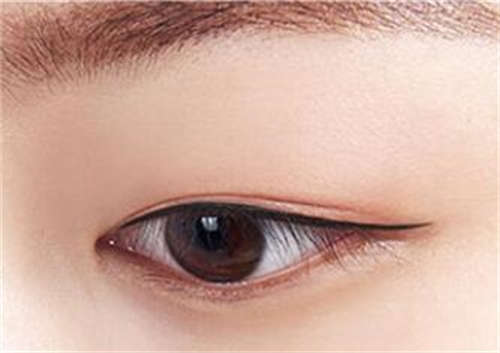 2023年菏泽市巨野县注射Botox去除眼部皱纹哪里的整形医院好且实惠