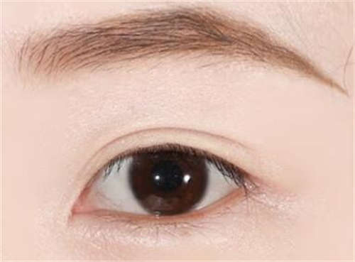 2023年昭通市水富县消眼袋去黑眼圈技术水平高的整形医生